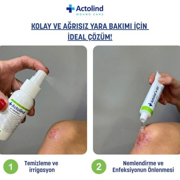 Actolind ® w Solution 250 ml | Yara İyileştirme Solüsyonu