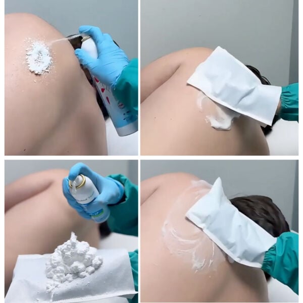 Actolind ® Foam 300 ml Vücut Temizleme Köpüğü
