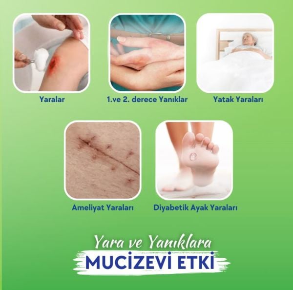 Actolind ® w Solution Monodose 10 x 5 ml | Yara İyileştirme Solüsyonu - Toptan Satış