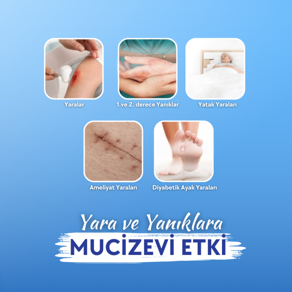 Actolind ® Solution Plus | Yara Bakım Solüsyonu - Toptan Satış
