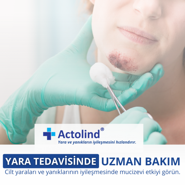 Actolind ® Solution Plus | Yara Bakım Solüsyonu - Toptan Satış 50 ml